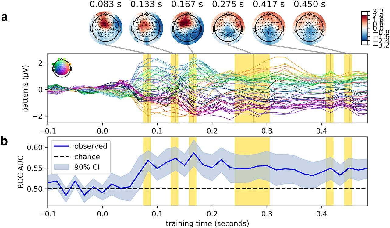 Temporal Dynamics of Brain Activity Predicting Sense of Agency over Muscle Movements